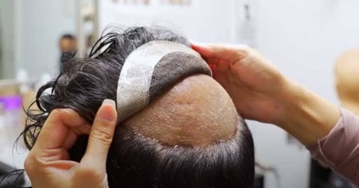 Hair Patch at Elevate Salon Wig House